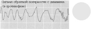 Сигнал обратной полярности с динамика (в противофазе)