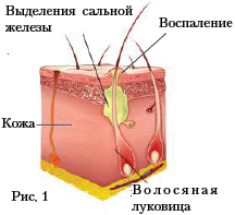 Рис. 1